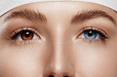 What Is Eye Color Change Surgery Or Iris Implant Surgery?