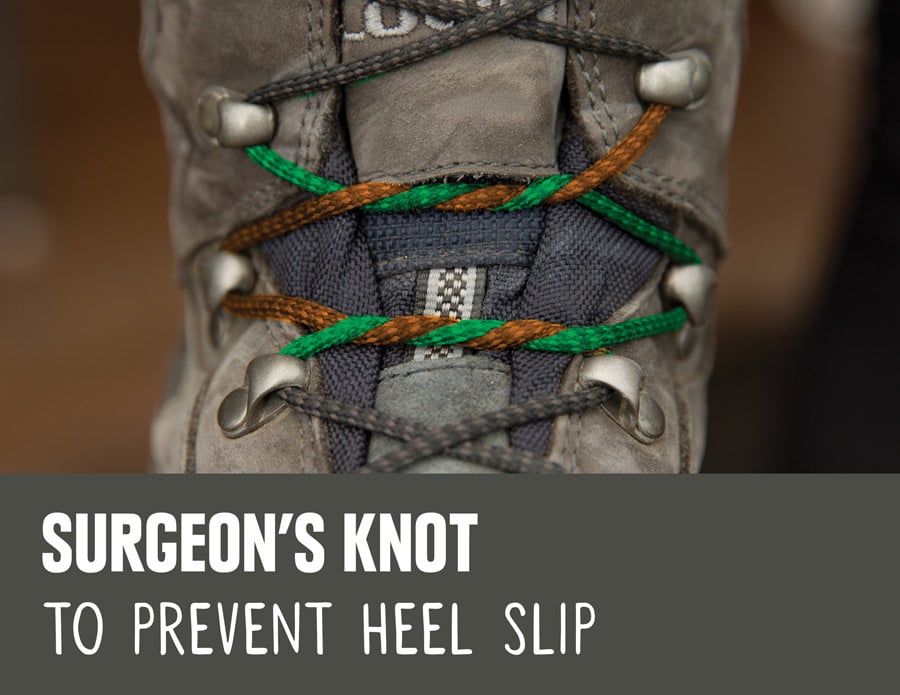  Surgeon&rsquo;s Knot