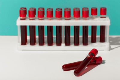 نمایندگی بانک خون بند ناف رویان