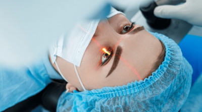 لیزر حذف عینک (نقد و اقساط)