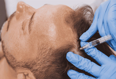 تزریق پی آر پی PRP